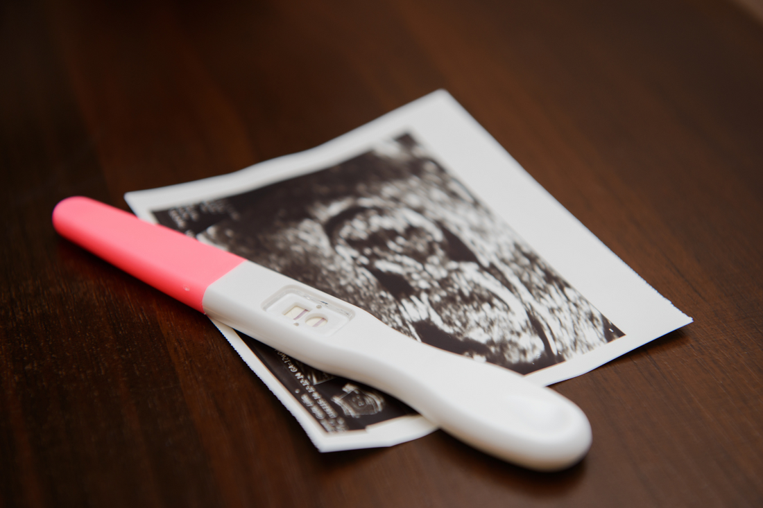 Menstruación y embarazo ectópico