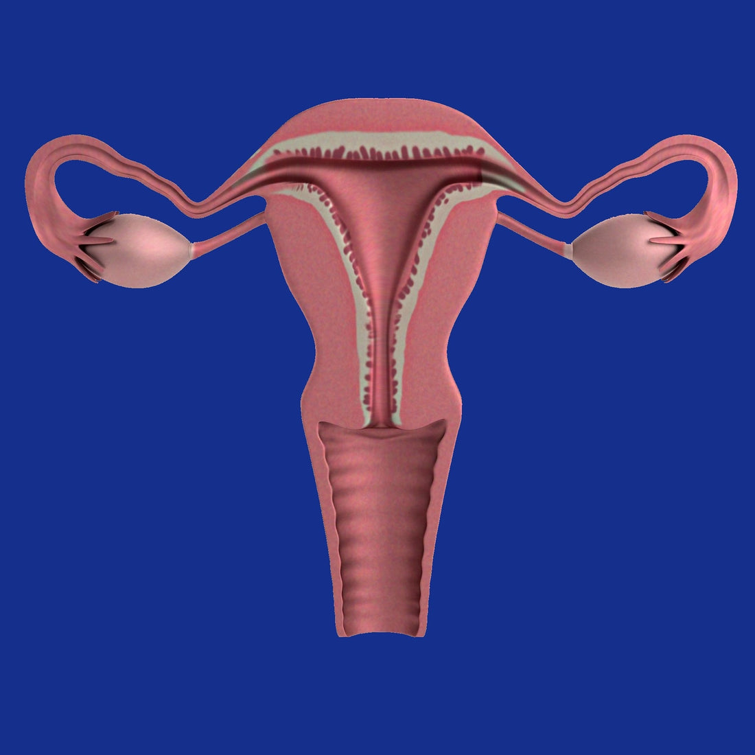 ovario-poliquistico